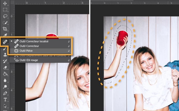 Bras indésirable sélectionné pour être supprimé avec l’outil Pièce du menu Correcteur localisé
