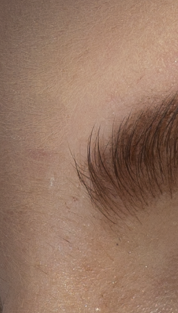 eyebrow-healed-diffusion-2 PS CC 2015.1(拡散 2)で修復