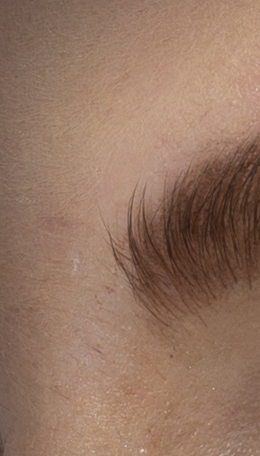 eyebrow-healed-diffusion-6 PS CC 2015.1(拡散 6)で修復