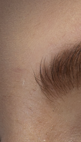 eyebrow-healed-2014 PS CC 2014 以前のバージョンで修復