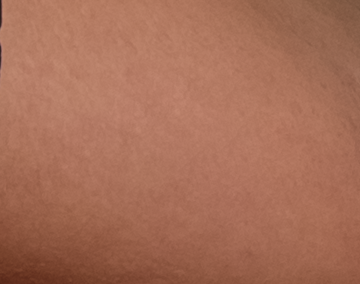 skin-healed-diffusion-4 PS CC 2015.1(拡散 4)で修復
