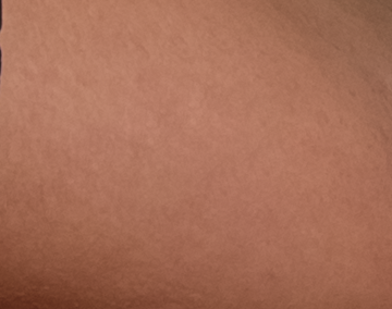 skin-healed-diffusion-5 PS CC 2015.1(拡散 5)で修復