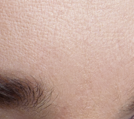 forehead-healed-diffusion-5 PS CC 2015.1(拡散 5)で修復