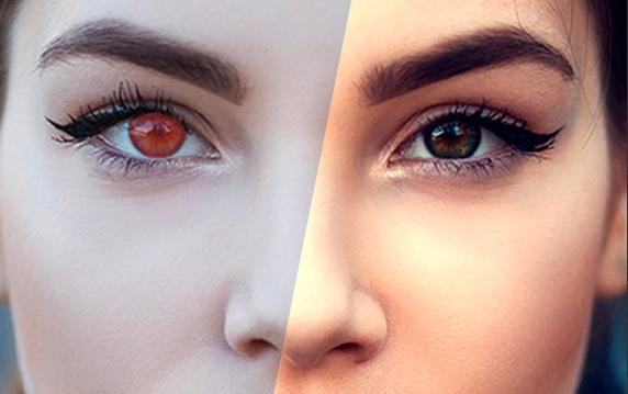 Lightroom의 적목 현상 수정